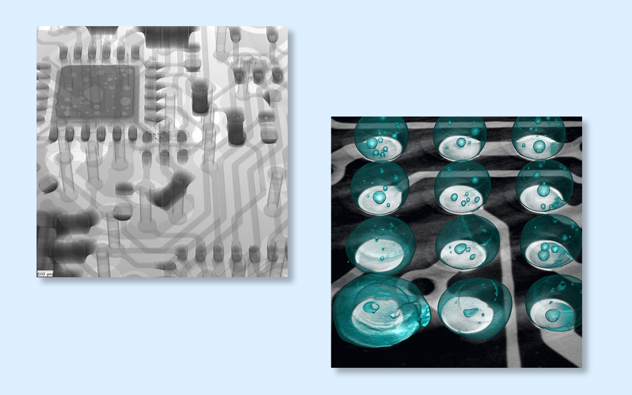 4. 2D vs 3D CT rentgen Kter&yacute; opravdu potřebujete?